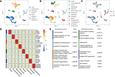 Single-Cell RNA-Seq Analysis Reveals Microenvironmental Infiltration of Plasma Cells and Hepatocytic Prognostic Markers in HCC With Cirrhosis